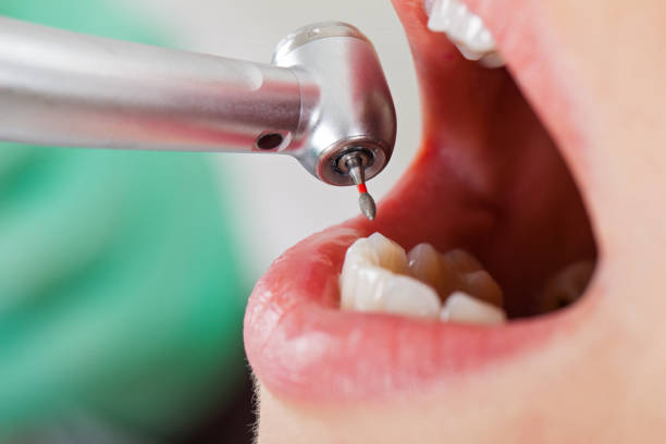 Best Emergency Dental Filling Replacement  in Lower Burrell, PA